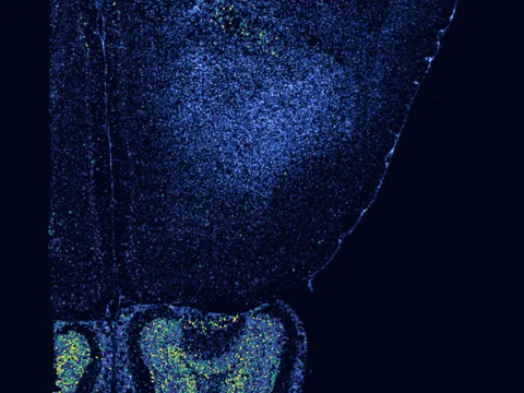 Mouse brain preview