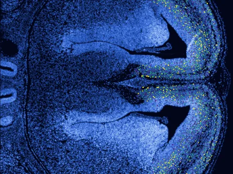 Mouse brain preview