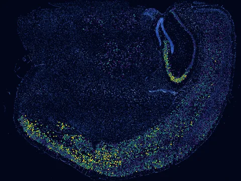 Mouse brain preview