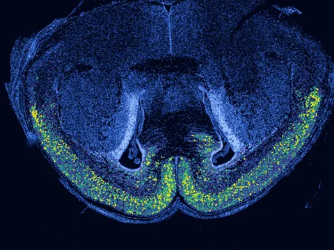 Mouse brain preview