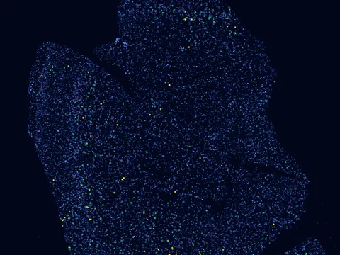 Human brain preview