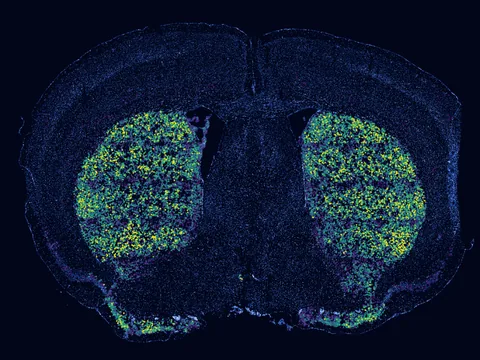 Mouse brain preview