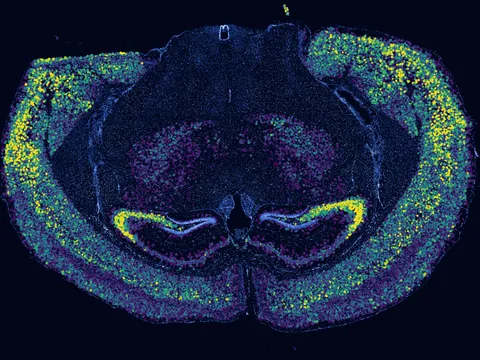 Mouse brain preview