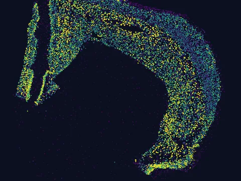 Mouse brain preview