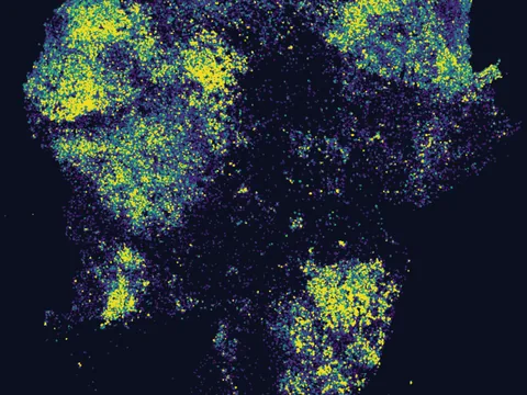 Human brain preview