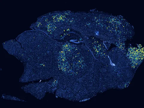 Mouse brain preview