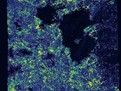 Human breast preview