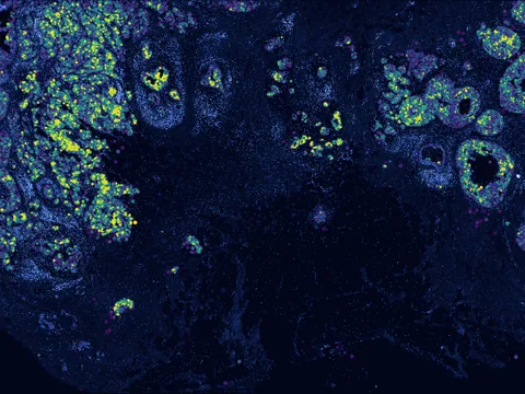 Human breast preview