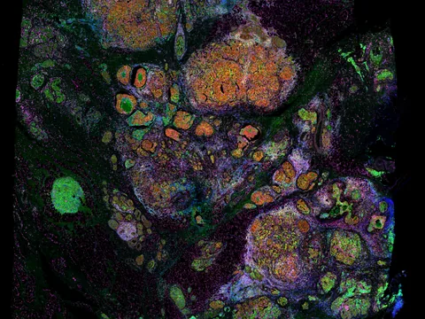 Human breast preview