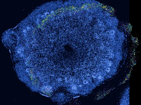 Human cerebral cortex preview