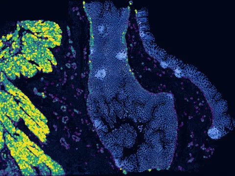 Human colon preview