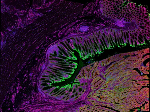 Human colon preview