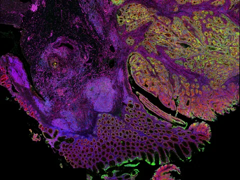 Human colon preview