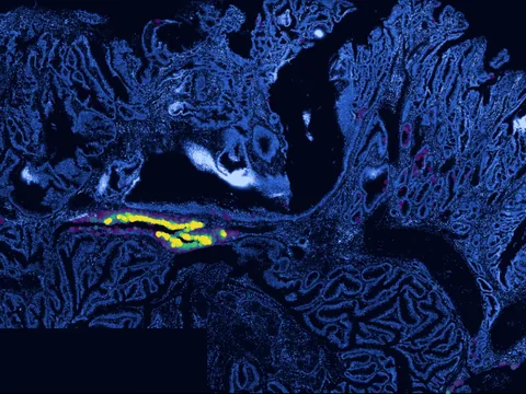 Human colon preview