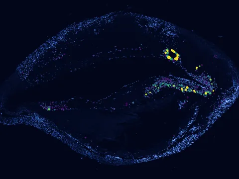 Human coronary artery preview