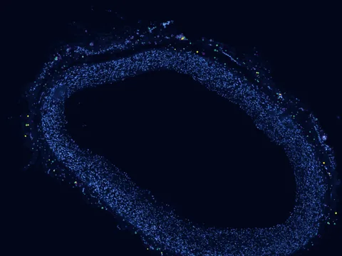 Human coronary artery preview