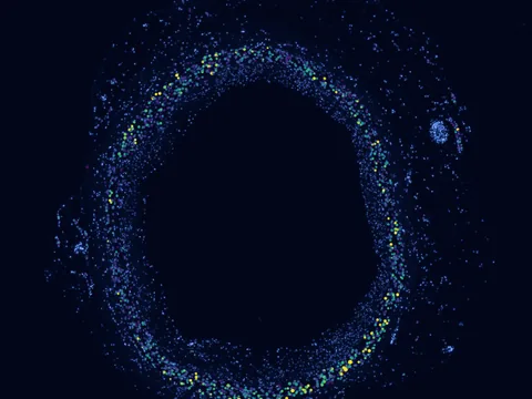 Human coronary artery preview