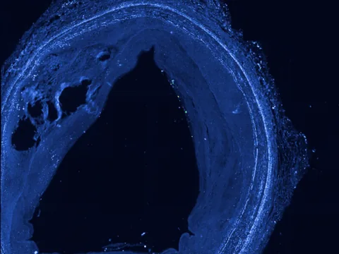 Human coronary artery preview