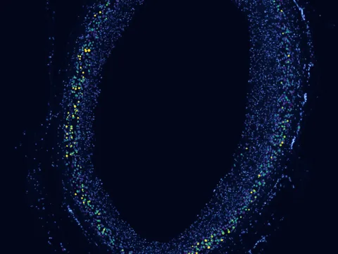 Human coronary artery preview