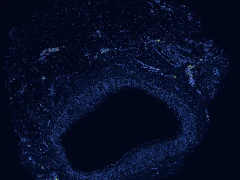 Human coronary artery preview