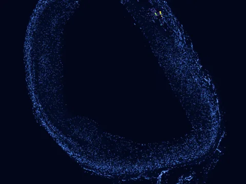 Human coronary artery preview