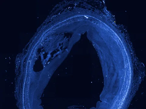 Human coronary artery preview