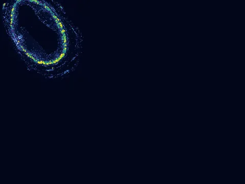 Human coronary artery preview