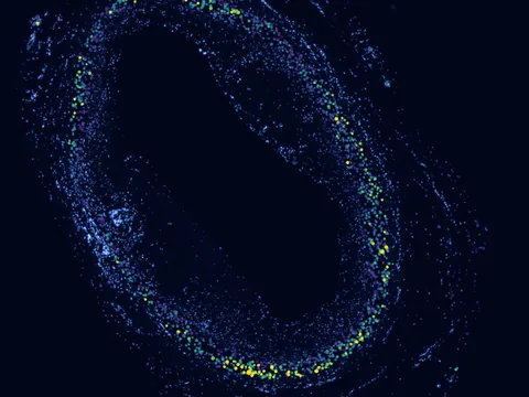 Human coronary artery preview