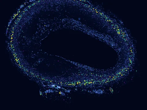 Human coronary artery preview