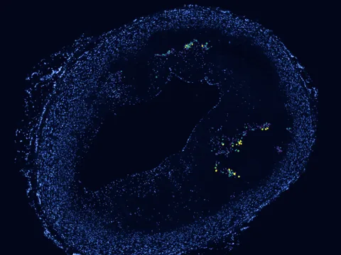 Human coronary artery preview