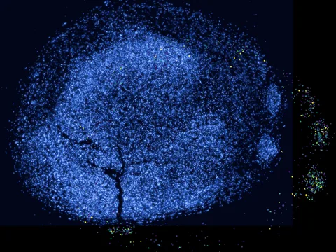 Human corpus striatum preview