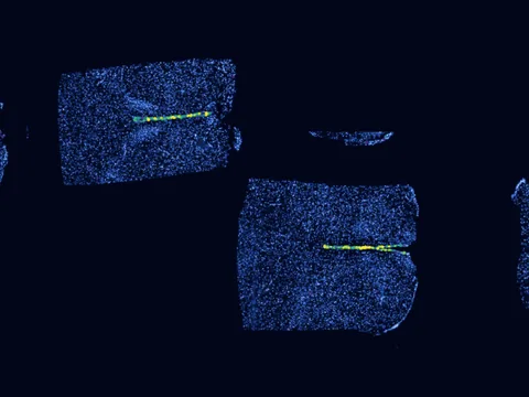 Mouse hypothalamus preview