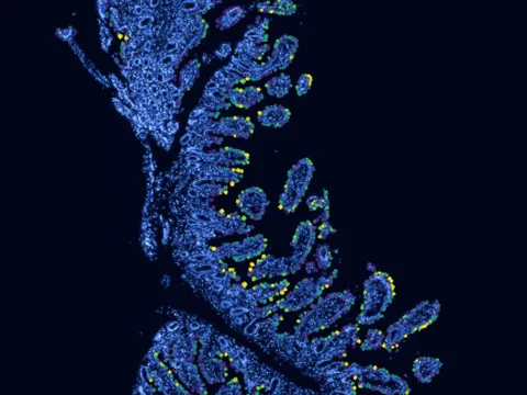 Human ileum preview