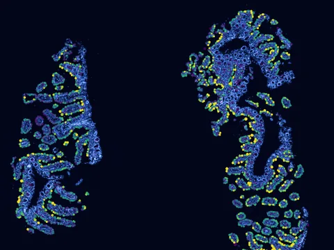 Human ileum preview