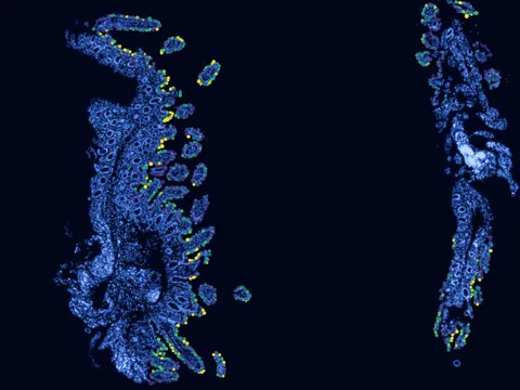 Human ileum preview