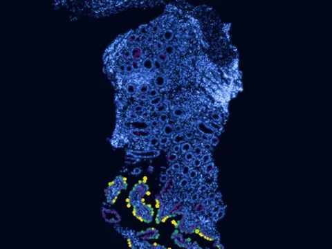 Human ileum preview