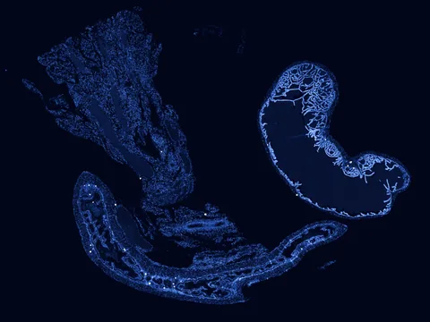 Mouse intestine preview