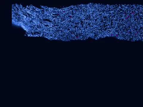 Human kidney preview