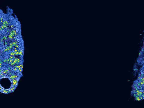 Human kidney preview