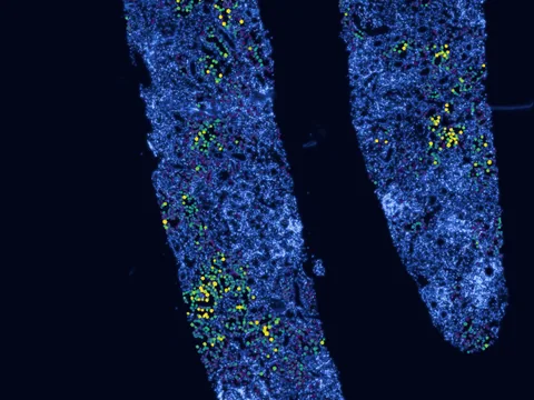 Human kidney preview