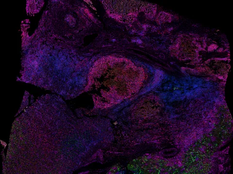 Human kidney preview