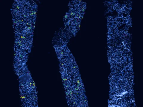 Human kidney preview