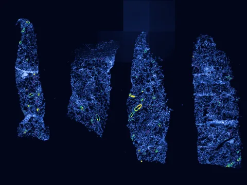 Human kidney preview