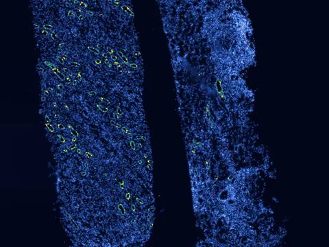 Human kidney preview