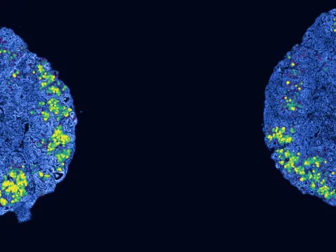 Human kidney preview