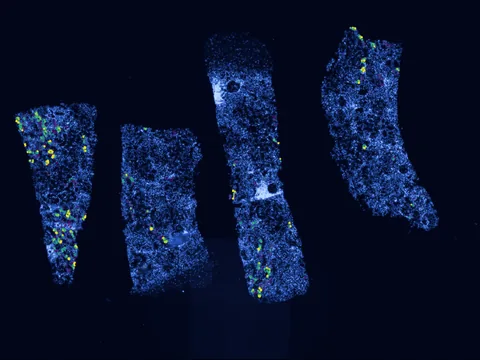 Human kidney preview