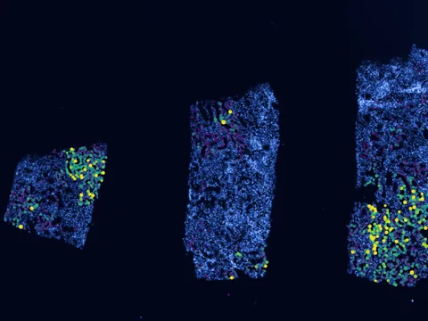 Human kidney preview