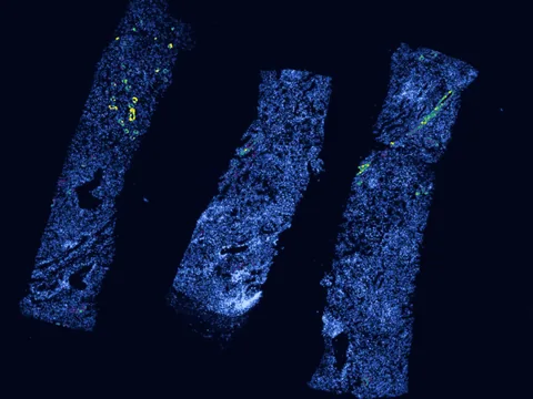 Human kidney preview