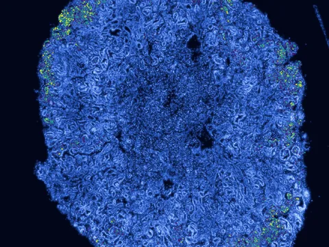 Human kidney preview