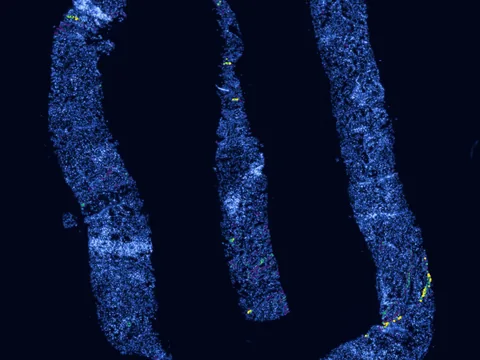 Human kidney preview